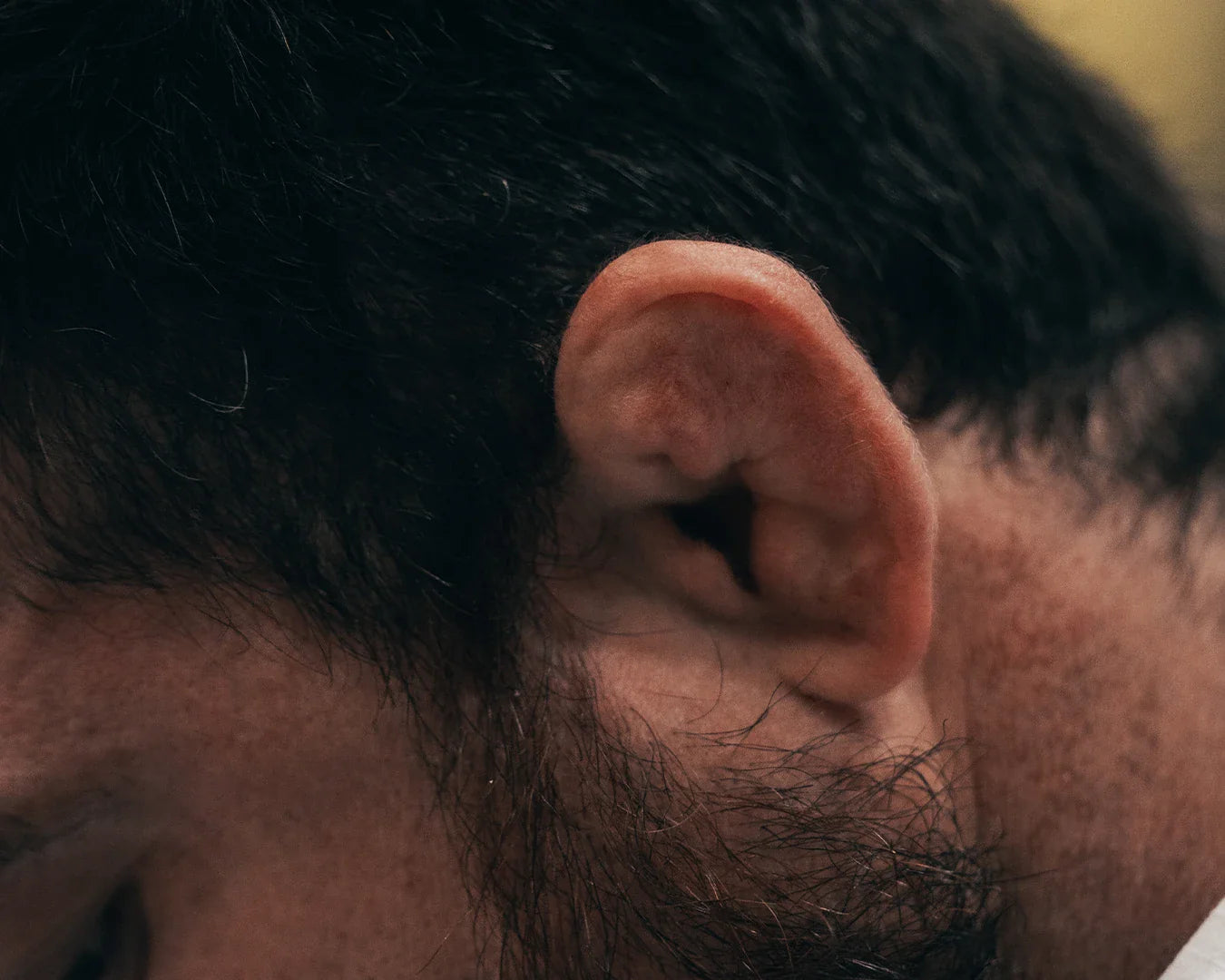 Jiu-Jitsu Ears (Cauliflower Ear): What Beginners Need to Know
